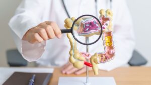 Câncer colorretal em jovens adultos acende alerta e reforça importância da prevenção