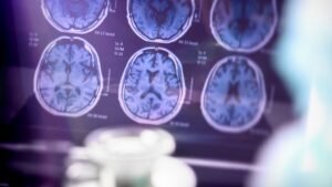 Alzheimer: caso de Fernando Henrique Cardoso chama atenção para os desafios da doença que afeta milhões de idosos